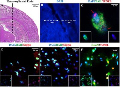 Acute Response and Neuroprotective Role of Myo/Nog Cells Assessed in a Rat Model of Focal Brain Injury